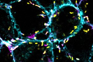 Microscopy image of parasites rocketing around inside cells